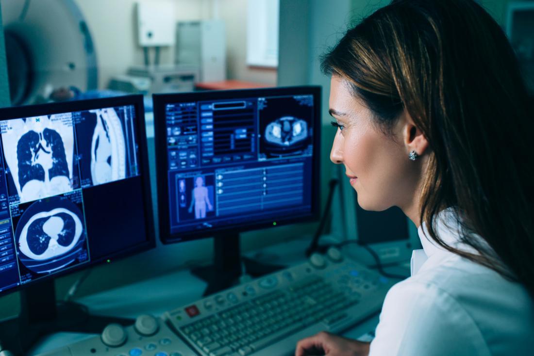 Lung cancer diagnosis focused on AI system 